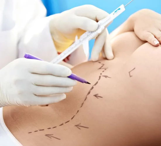 Surgical Scar Removal Treatment