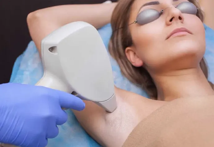 Effective Laser Hair Removal in Kuwait