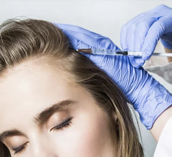 PRP Hair Loss Treatment in Kuwait